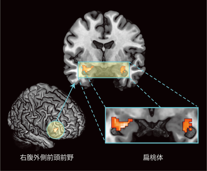 図1　死関連の文字を処理している際の脳領域間機能結合